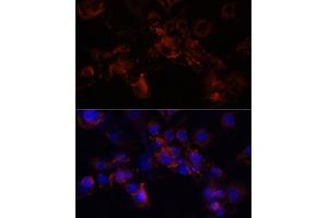 Immunofluorescence analysis of NIH/3T3 cells using STXBP1 antibody (ABIN6128255, ABIN6148673, ABIN6148674 and ABIN6221073) at dilution of 1:100 (40x lens). (STXBP1 anticorps  (AA 295-594))