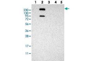 Western blot analysis of Lane 1: RT-4, Lane 2: U-251 MG, Lane 3: Human Plasma, Lane 4: Liver, Lane 5: Tonsil with MPDZ polyclonal antibody . (MPDZ anticorps)