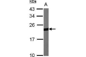 WB Image Sample (30 ug of whole cell lysate) A:NIH-3T3 12% SDS PAGE antibody diluted at 1:1000 (Peroxiredoxin 1 anticorps)