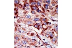 Image no. 2 for anti-Adenylate Kinase 2 (AK2) (C-Term) antibody (ABIN360625) (Adenylate Kinase 2 anticorps  (C-Term))