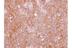 IHC-P Image Immunohistochemical analysis of paraffin-embedded BT474 xenograft, using AHCYL2, antibody at 1:100 dilution. (AHCYL2 anticorps)