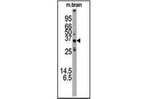 Western blot analysis using ATG5 Antibody (N-term) Cat.