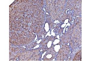 IHC analysis of PDIA6 using anti-PDIA6 antibody (ABIN7600553). (PDIA6 anticorps  (AA 20-440))