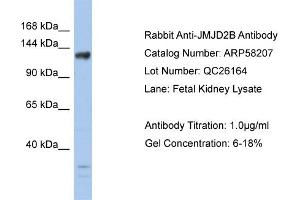 WB Suggested Anti-JMJD2B  Antibody Titration: 0. (KDM4B anticorps  (Middle Region))