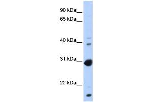 WB Suggested Anti-NR0B2 Antibody Titration:  0. (NR0B2 anticorps  (Middle Region))