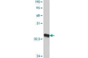 Western Blot detection against Immunogen (38.