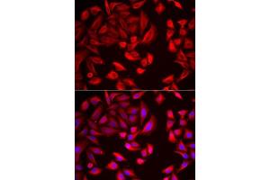 Immunofluorescence analysis of HeLa cells using CCT2 antibody. (CCT2 anticorps  (AA 206-535))