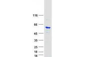 Validation with Western Blot