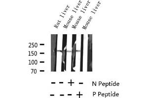 Western blot analysis of Phospho-EGFR (Ser1070) expression in various lysates