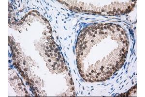 Immunohistochemical staining of paraffin-embedded Human Kidney tissue using anti-MTRF1L mouse monoclonal antibody. (MTRF1L anticorps)
