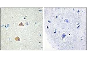 Immunohistochemistry analysis of paraffin-embedded human brain tissue, using EFNA5 Antibody. (Ephrin A5 anticorps  (AA 31-80))
