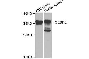Western blot analysis of extracts of various cell lines, using CEBPE antibody. (CEBPE anticorps  (AA 1-190))