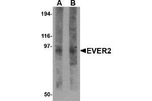 Western blot analysis of EVER2 in rat thymus tissue lysate with AP30324PU-N EVER2 antibody at (A) 1 and (B) 2 μg/ml. (TMC8 anticorps  (N-Term))