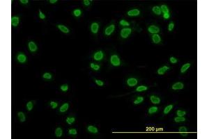 Image no. 2 for anti-TATA Box Binding Protein Associated Factor 11 (TAF11) (AA 158-211) antibody (ABIN598957) (TAF11 anticorps  (AA 158-211))
