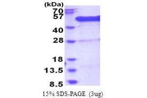 SDS-PAGE (SDS) image for BRCA2 and CDKN1A Interacting Protein (BCCIP) (AA 1-314) protein (His tag) (ABIN5853793) (BCCIP Protein (AA 1-314) (His tag))