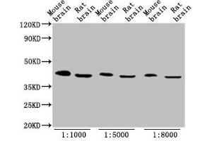 Western Blot Positive WB detected in: Mouse brain tissue, Rat brain tissue All lanes: OCT4 antibody at 1:1000, 1:5000, 1:8000 Secondary Goat polyclonal to Mouse IgG at 1/10000 dilution Predicted band size: 39, 31 kDa Observed band size: 45 kDa (OCT4 anticorps  (AA 1-360))