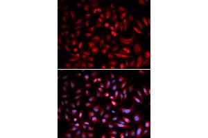 Immunofluorescence analysis of U2OS cells using PRKACB antibody (ABIN5973065).