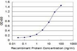 anti-Structural Maintenance of Chromosomes 3 (SMC3) (AA 711-810) antibody