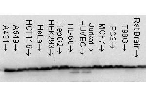 Hsp60 Western Blot.