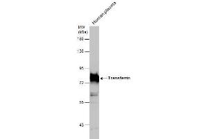 WB Image Human tissue extract (30 μg) was separated by 7. (Transferrin anticorps)