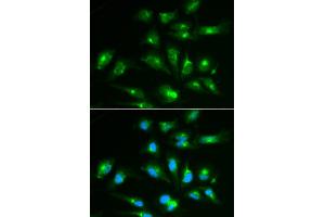 Immunofluorescence analysis of HepG2 cells using CD46 antibody (ABIN6293305). (CD46 anticorps)