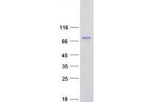 Validation with Western Blot