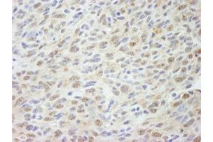 Immunohistochemistry (IHC) image for anti-Mediator Complex Subunit 18 (MED18) (C-Term) antibody (ABIN7448663) (MED18 anticorps  (C-Term))