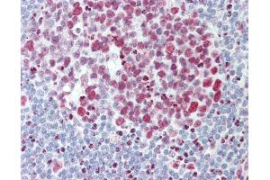 Anti-HNRNPAB antibody IHC staining of human tonsil. (HNRNPAB anticorps  (AA 1-30))