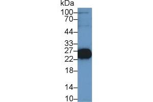 Western Blot; Sample: Mouse Skeletal muscle lysate; Primary Ab: 1µg/ml Rabbit Anti-Rat TNNI2 Antibody Second Ab: 0. (TNNI2 anticorps  (AA 1-182))