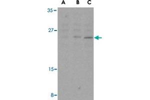 Western blot analysis of BCL2 in A-20 cell lysates with BCL2 polyclonal antibody  at (A) 1, (B) 2, and (C) 4 ug/mL . (Bcl-2 anticorps  (Internal Region))