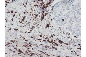 Image no. 3 for anti-Coagulation Factor XIII, A1 Polypeptide (F13A1) antibody (ABIN1498150)