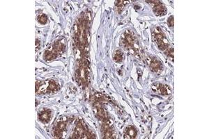Immunohistochemical staining of human breast with C1orf35 polyclonal antibody  shows moderate cytoplasmic and nuclear positivity in glandular cell at 1:500-1:1000 dilution.