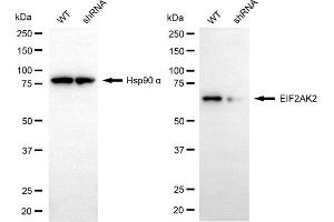 Western blotting analysis using EIF2AK2 antibody (ABIN7798506). (EIF2AK2 anticorps)