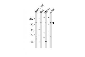 All lanes : Anti-PLCG1 Antibody (Center) at 1:2000 dilution Lane 1: CCRF-CEM whole cell lysates Lane 2: Hela whole cell lysates Lane 3: MCF-7 whole cell lysates Lane 4: Jurkat whole cell lysates Lysates/proteins at 20 μg per lane.
