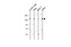 All lanes : Anti-PLCG1 Antibody (Center) at 1:2000 dilution Lane 1: CCRF-CEM whole cell lysates Lane 2: Hela whole cell lysates Lane 3: MCF-7 whole cell lysates Lane 4: Jurkat whole cell lysates Lysates/proteins at 20 μg per lane. (Phospholipase C gamma 1 anticorps  (AA 456-488))