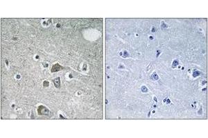 Immunohistochemistry (IHC) image for anti-Fibulin 2 (FBLN2) (AA 241-290) antibody (ABIN2890318) (FBLN2 anticorps  (AA 241-290))