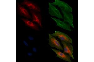 ABIN6257350 and ABIN6274727 staining  cells by IF/ICC. (MRPL11 anticorps  (Internal Region))