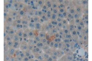 Detection of SFTPA1 in Rat Liver Tissue using Polyclonal Antibody to Pulmonary Surfactant Associated Protein A1 (SFTPA1)