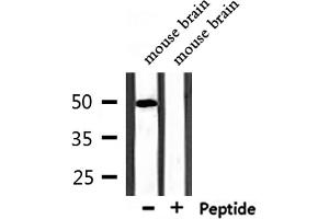 Western blot analysis of extracts from mouse brain, using MUC13 Antibody.