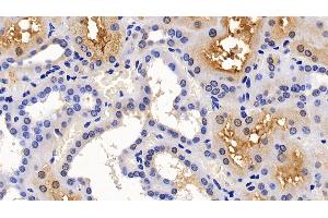 Detection of ACE2 in Human Kidney Tissue using Polyclonal Antibody to Angiotensin I Converting Enzyme 2 (ACE2)