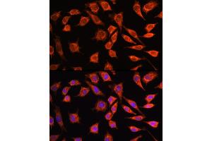 Immunofluorescence analysis of L929 cells using MRPL45 Rabbit pAb (ABIN6133218, ABIN6144020, ABIN6144021 and ABIN6217105) at dilution of 100 (40x lens). (MRPL45 anticorps  (AA 57-306))