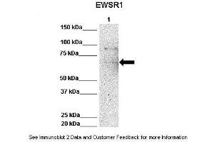 Lanes:   Lane 1: 50ug Hela Lysate  Primary Antibody Dilution:   1:1000  Secondary Antibody:   Anti-rabbit-HRP  Secondary Antibody Dilution:   1:10,000  Gene Name:   EWSR1  Submitted by:   Archa Fox, University of Western Australia  EWSR1 is strongly supported by BioGPS gene expression data to be expressed in Human HeLa cells