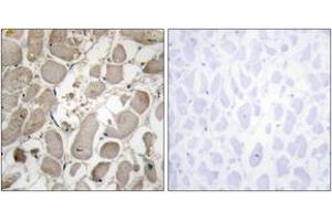 Immunohistochemistry analysis of paraffin-embedded human heart tissue, using Collagen V alpha1 Antibody.