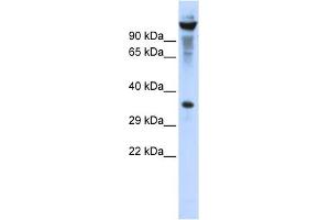WB Suggested Anti-RNASET2 Antibody Titration:  0. (RNASET2 anticorps  (Middle Region))