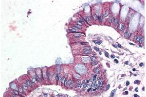 Human Colon (formalin-fixed, paraffin-embedded) stained with GPR116 antibody ABIN399995 at 10 ug/ml followed by biotinylated goat anti-rabbit IgG secondary antibody ABIN481713, alkaline phosphatase-streptavidin and chromogen. (G Protein-Coupled Receptor 116 anticorps  (Internal Region))