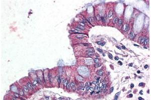 Human Colon (formalin-fixed, paraffin-embedded) stained with GPR116 antibody ABIN399995 at 10 ug/ml followed by biotinylated goat anti-rabbit IgG secondary antibody ABIN481713, alkaline phosphatase-streptavidin and chromogen. (G Protein-Coupled Receptor 116 anticorps  (Internal Region))
