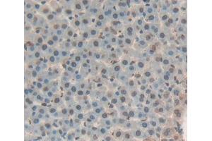 IHC-P analysis of liver tissue, with DAB staining. (THYN1 anticorps  (AA 1-226))