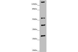 Western blot All lanes: ZSCAN26antibody at 1. (ZNF187 anticorps  (AA 239-478))