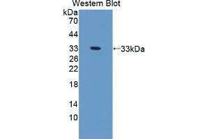 Western blot analysis of the recombinant protein. (TREH anticorps  (AA 151-411))