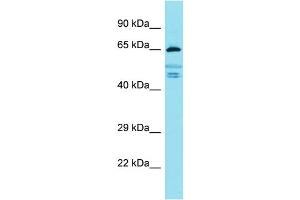 Western Blotting (WB) image for anti-Fidgetin-Like 2 (FIGNL2) (Middle Region) antibody (ABIN2791546) (Fidgetin-Like 2 anticorps  (Middle Region))